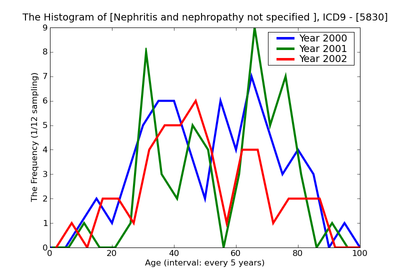 ICD9 Histogram Nephritis and nephropathy not specified as acute or chronic with lesion of proliferative glomerulone