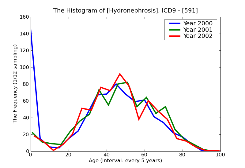 ICD9 Histogram Hydronephrosis