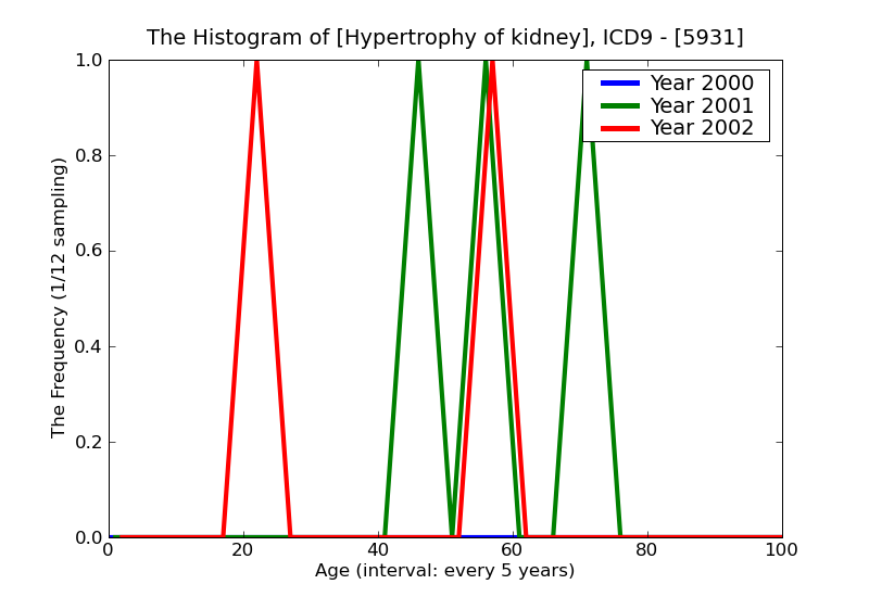 ICD9 Histogram Hypertrophy of kidney
