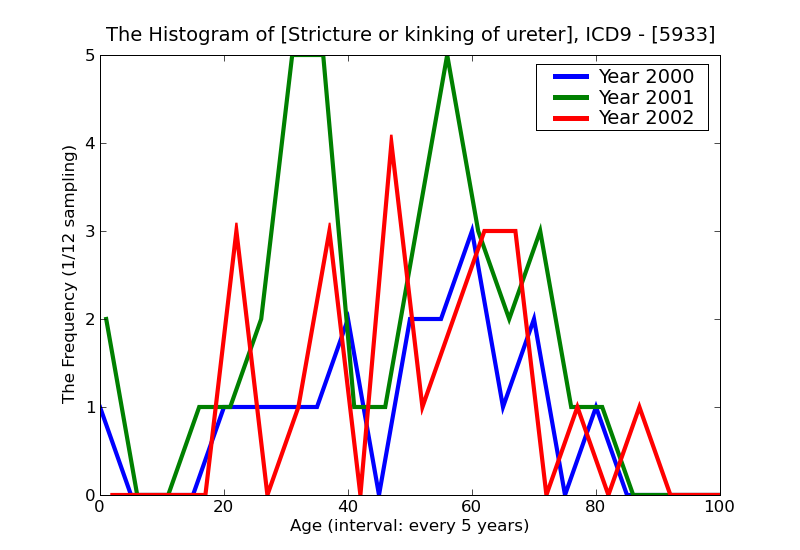 ICD9 Histogram Stricture or kinking of ureter