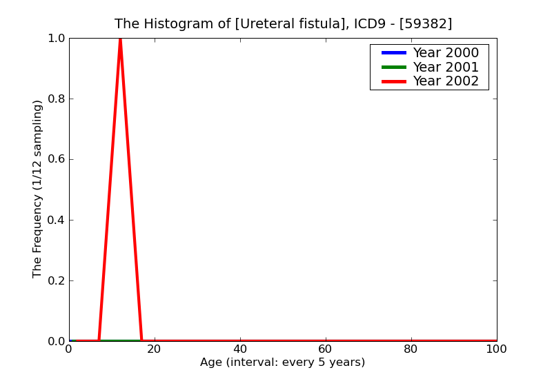 ICD9 Histogram Ureteral fistula