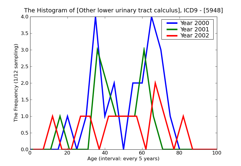 ICD9 Histogram Other lower urinary tract calculus