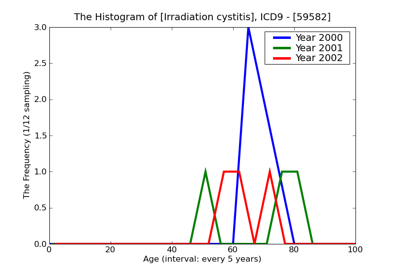 ICD9 Histogram Irradiation cystitis