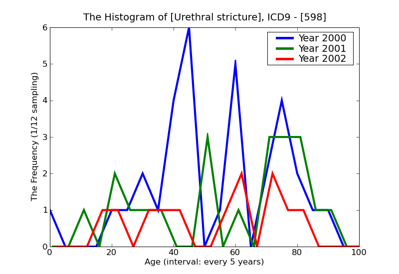 ICD9 Histogram Urethral stricture