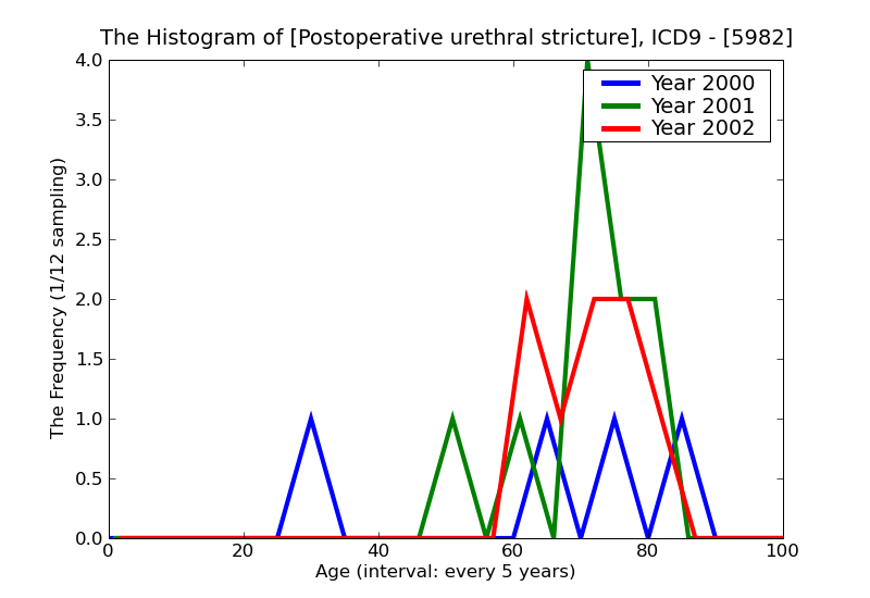 ICD9 Histogram Postoperative urethral stricture