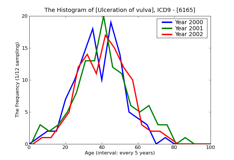 ICD9 Histogram Ulceration of vulva