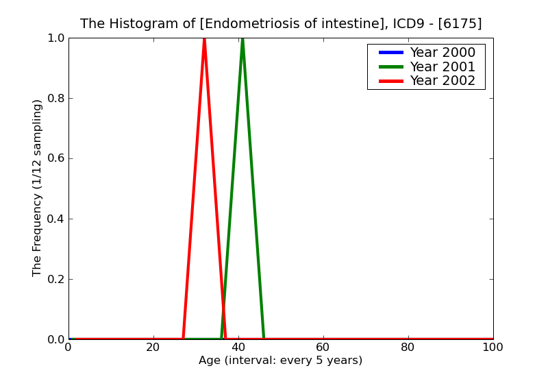 ICD9 Histogram Endometriosis of intestine