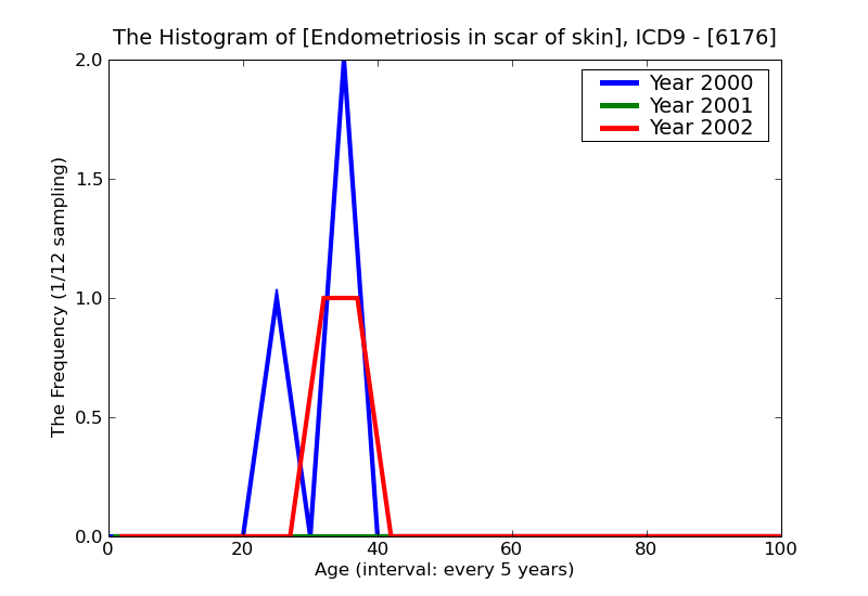 ICD9 Histogram Endometriosis in scar of skin