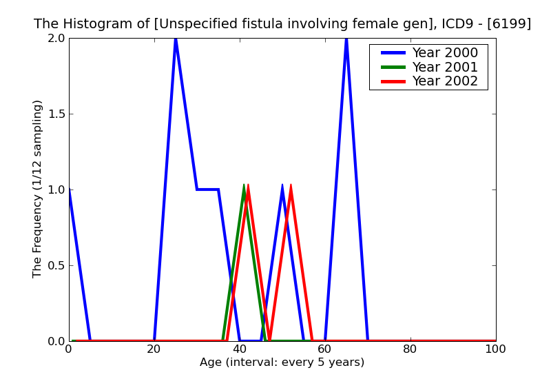 ICD9 Histogram Unspecified fistula involving female genital tract