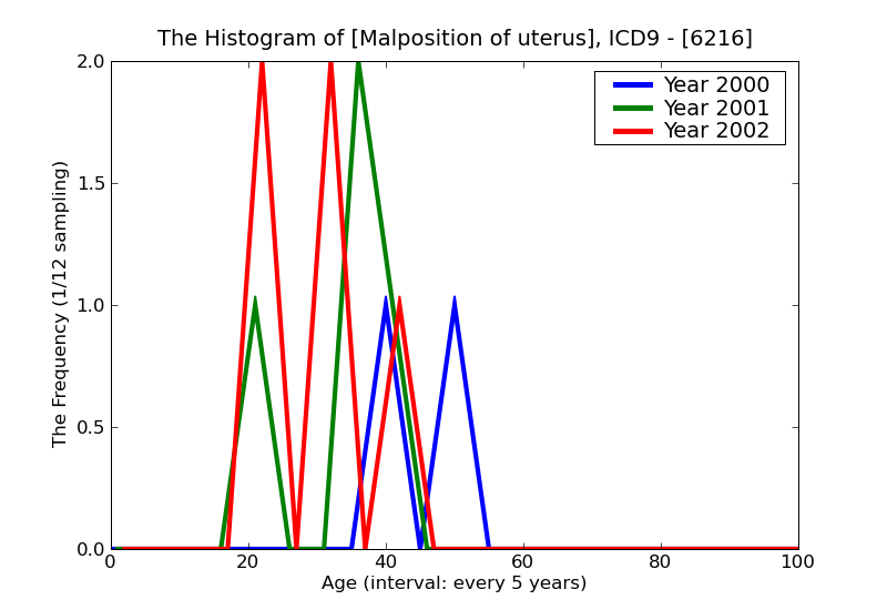 ICD9 Histogram Malposition of uterus