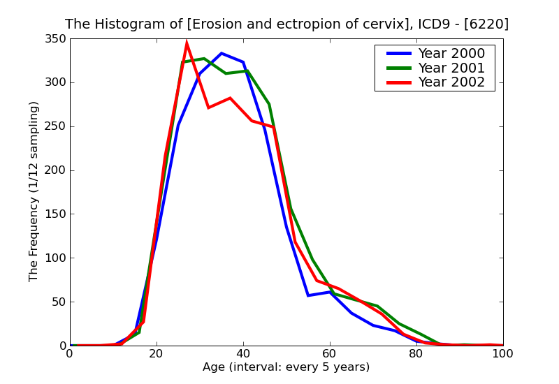 ICD9 Histogram Erosion and ectropion of cervix