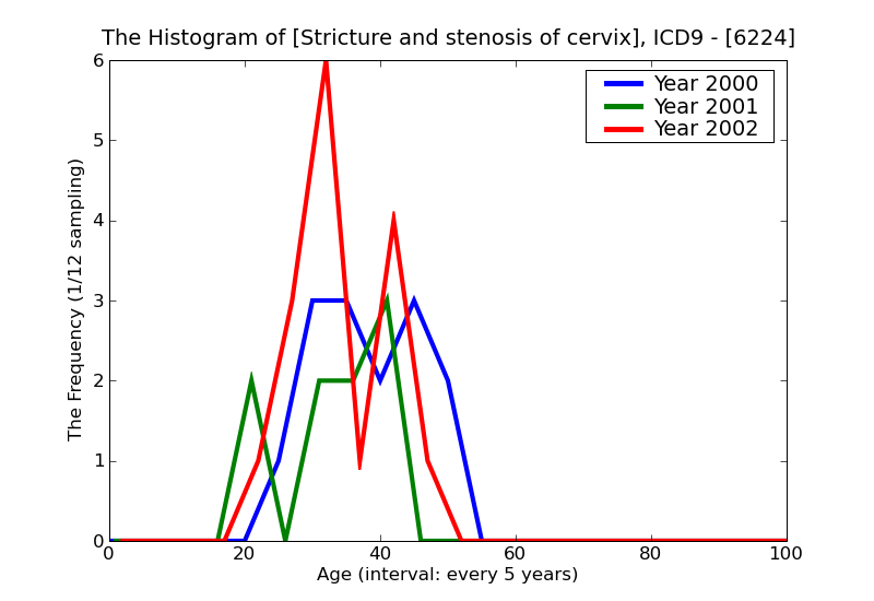 ICD9 Histogram Stricture and stenosis of cervix