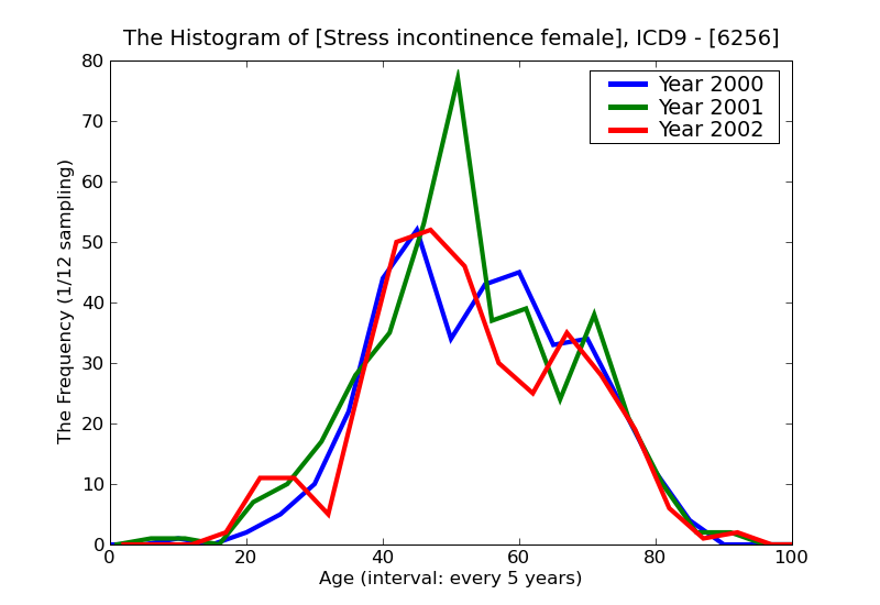 ICD9 Histogram Stress incontinence female