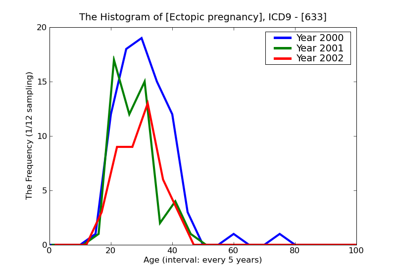 ICD9 Histogram Ectopic pregnancy