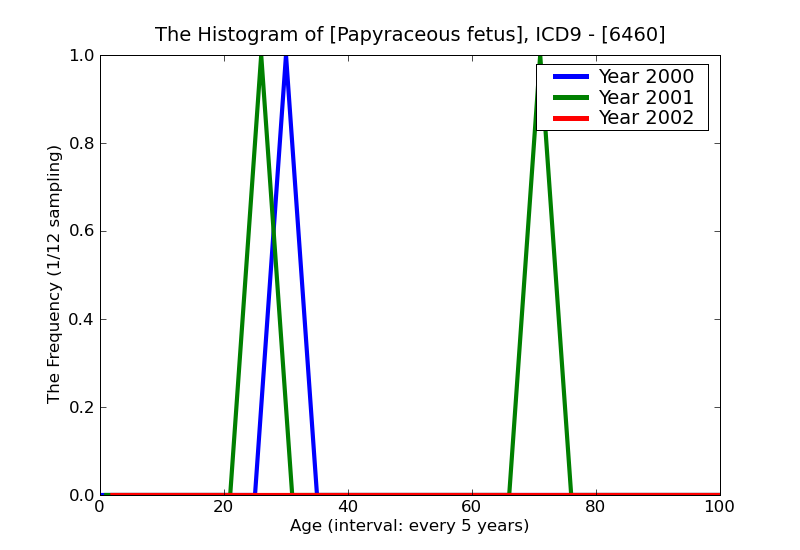ICD9 Histogram Papyraceous fetus