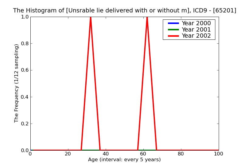 ICD9 Histogram Unsrable lie delivered with or without mention of antepartum condition