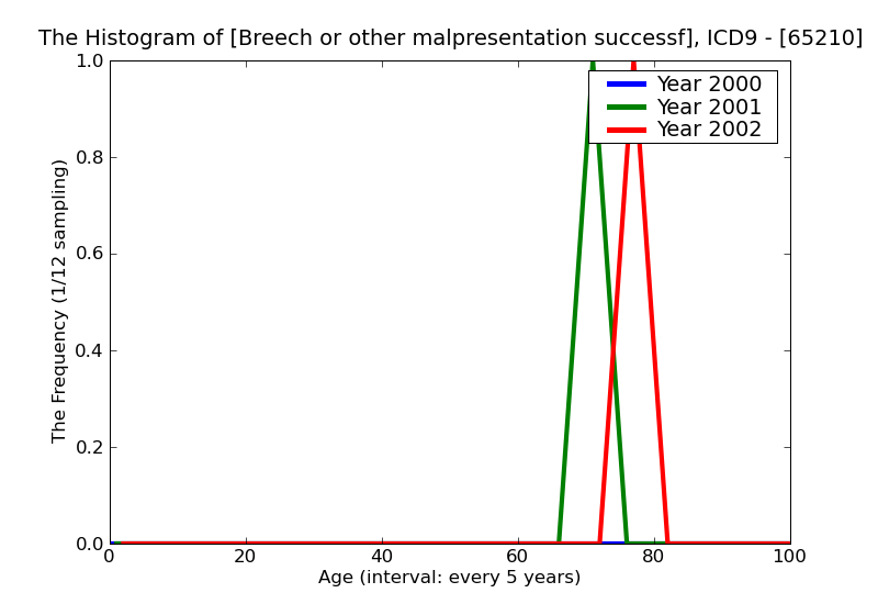 ICD9 Histogram Breech or other malpresentation successfully converted to cephalic presentation unspecified as to ep