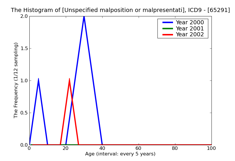 ICD9 Histogram Unspecified malposition or malpresentation delivered with or without mention of antepartum condition