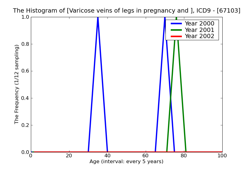 ICD9 Histogram Varicose veins of legs in pregnancy and the puerperium antepartum condition or complication