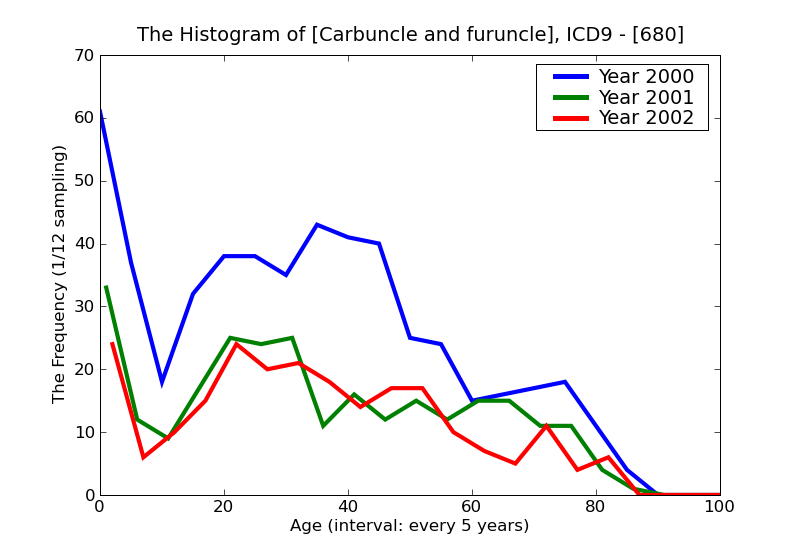 ICD9 Histogram Carbuncle and furuncle