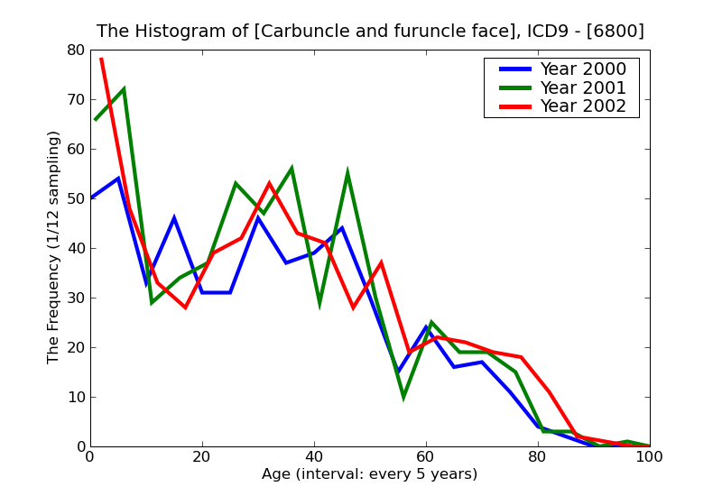 ICD9 Histogram Carbuncle and furuncle face