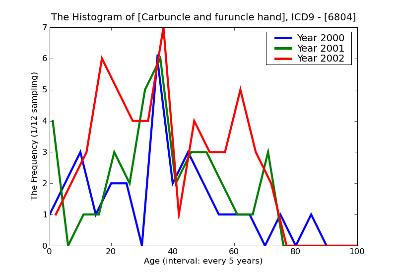 ICD9 Histogram Carbuncle and furuncle hand