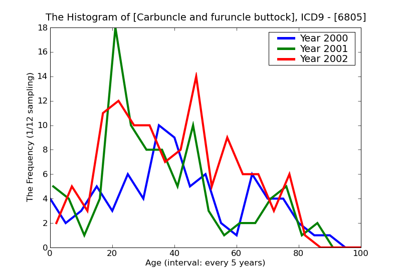 ICD9 Histogram Carbuncle and furuncle buttock