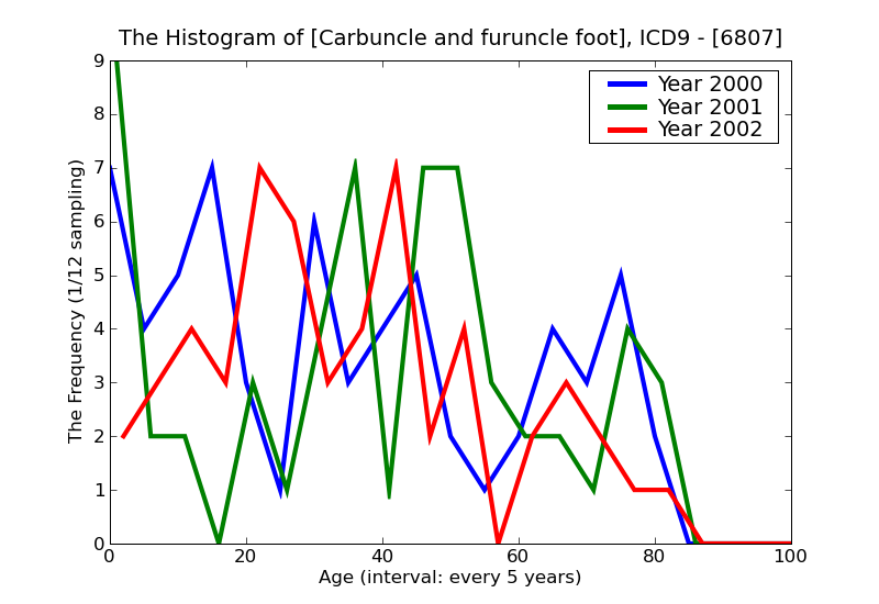 ICD9 Histogram Carbuncle and furuncle foot