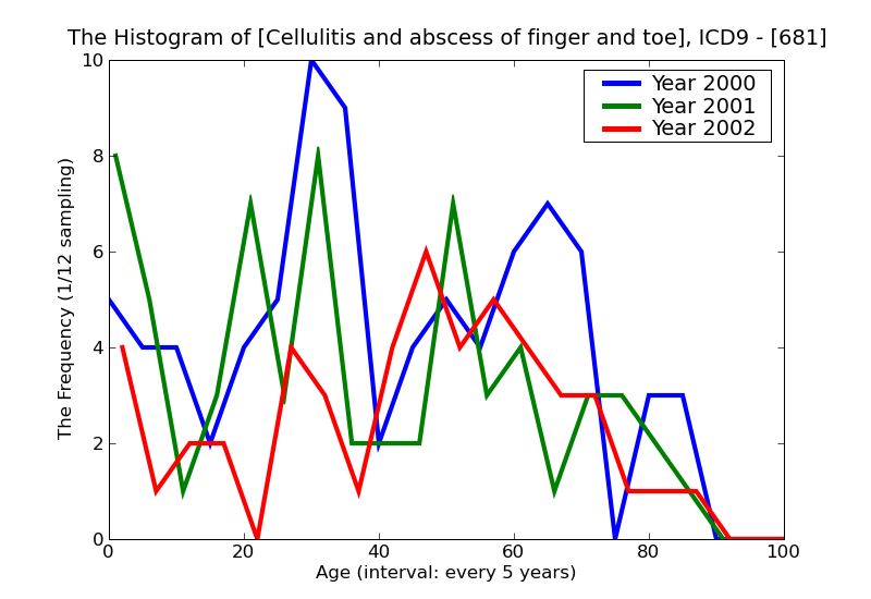 ICD9 Histogram Cellulitis and abscess of finger and toe