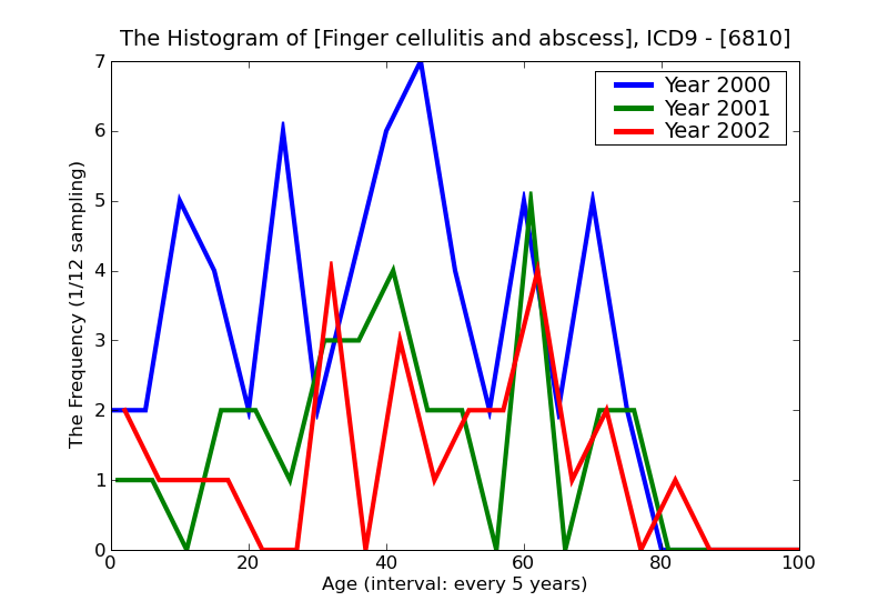 ICD9 Histogram Finger cellulitis and abscess