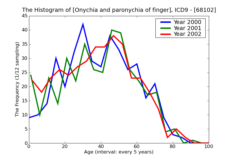 ICD9 Histogram Onychia and paronychia of finger