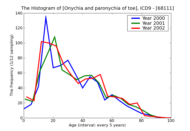 ICD9 Histogram Onychia and paronychia of toe