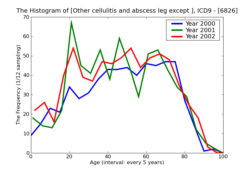 ICD9 Histogram Other cellulitis and abscess leg except foot