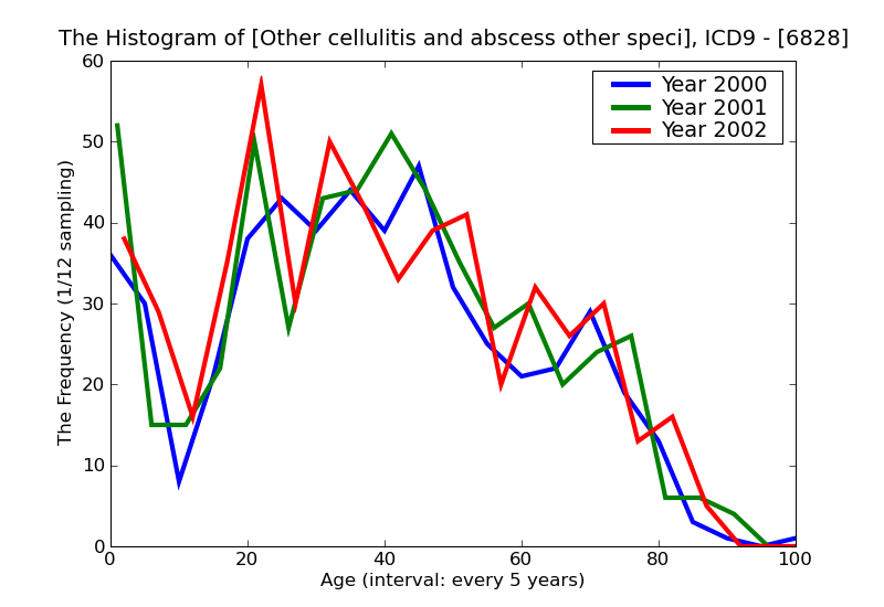 ICD9 Histogram Other cellulitis and abscess other specified sites