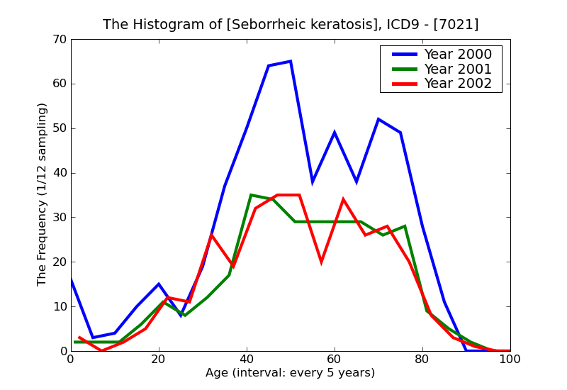 ICD9 Histogram Seborrheic keratosis