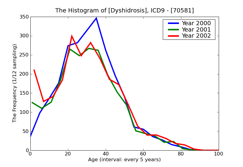 ICD9 Histogram Dyshidrosis