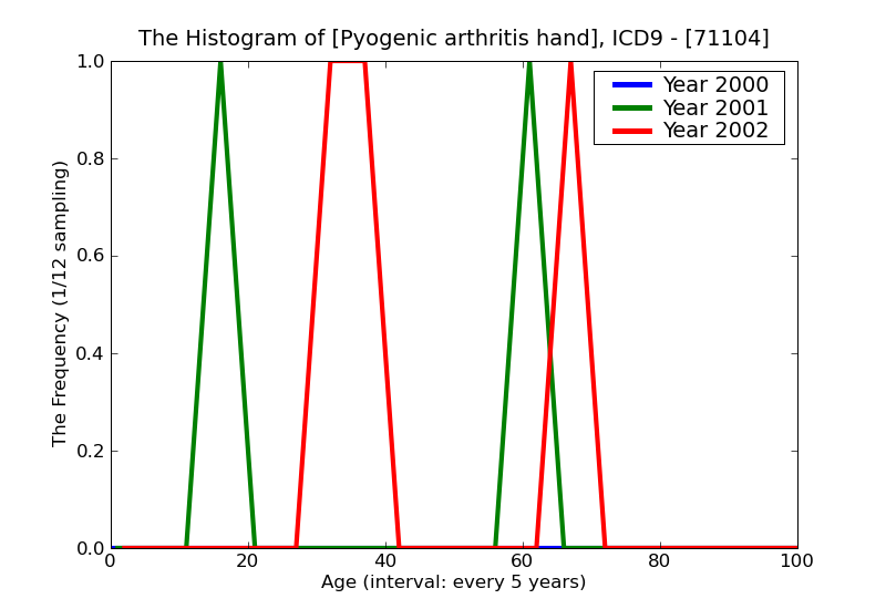 ICD9 Histogram Pyogenic arthritis hand