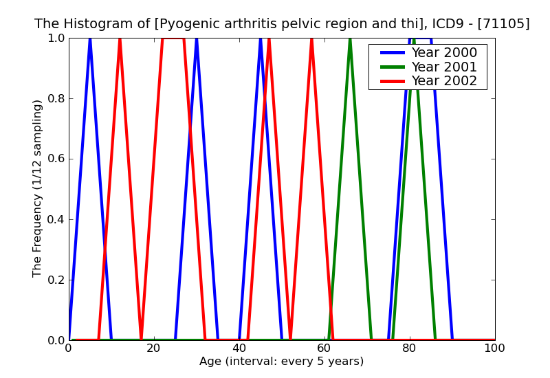 ICD9 Histogram Pyogenic arthritis pelvic region and thigh