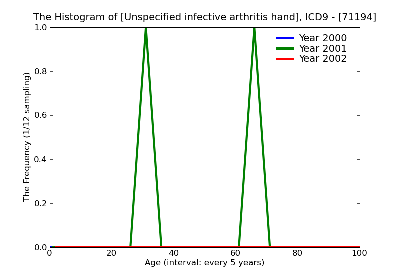 ICD9 Histogram Unspecified infective arthritis hand