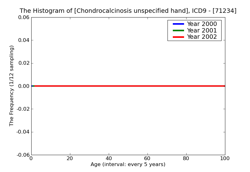 ICD9 Histogram Chondrocalcinosis unspecified hand