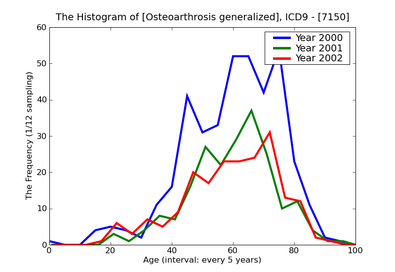 ICD9 Histogram Osteoarthrosis generalized