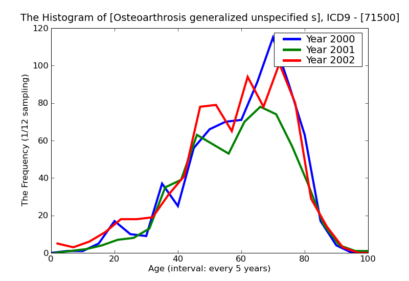 ICD9 Histogram Osteoarthrosis generalized unspecified site