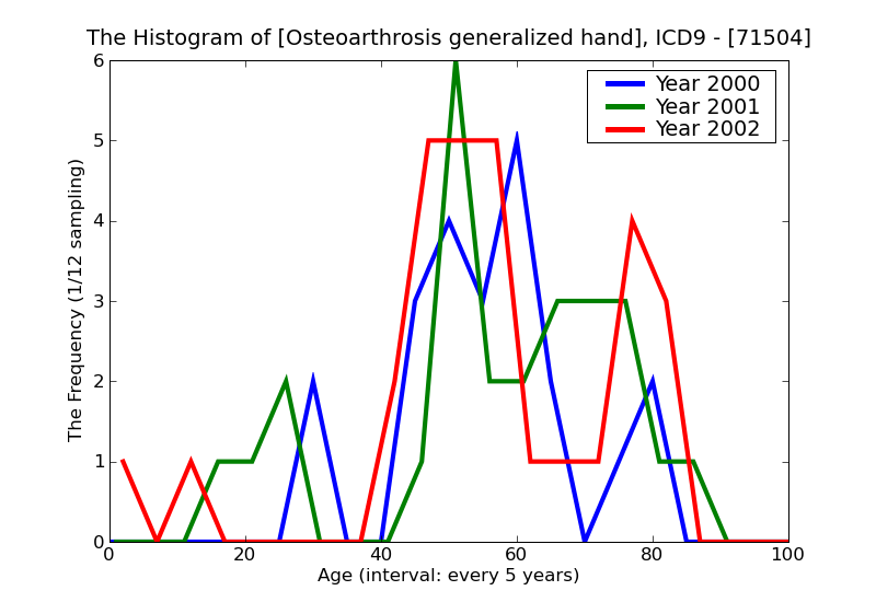 ICD9 Histogram Osteoarthrosis generalized hand