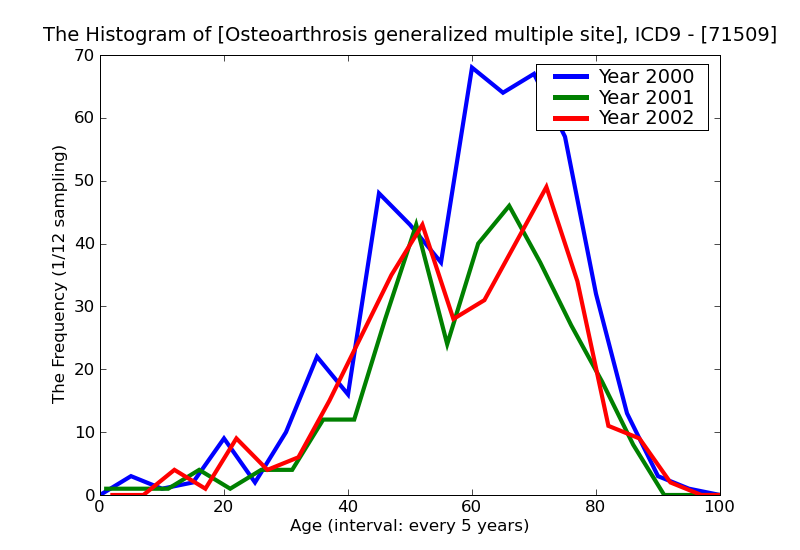 ICD9 Histogram Osteoarthrosis generalized multiple sites