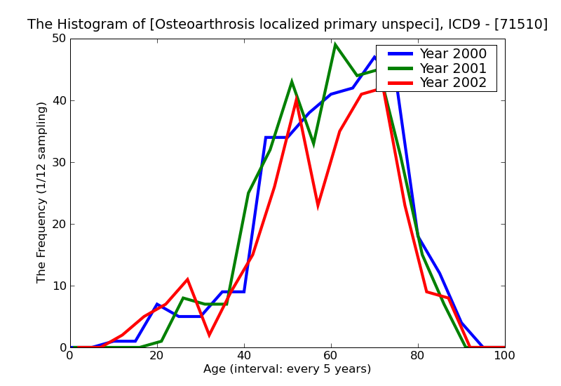 ICD9 Histogram Osteoarthrosis localized primary unspecified site
