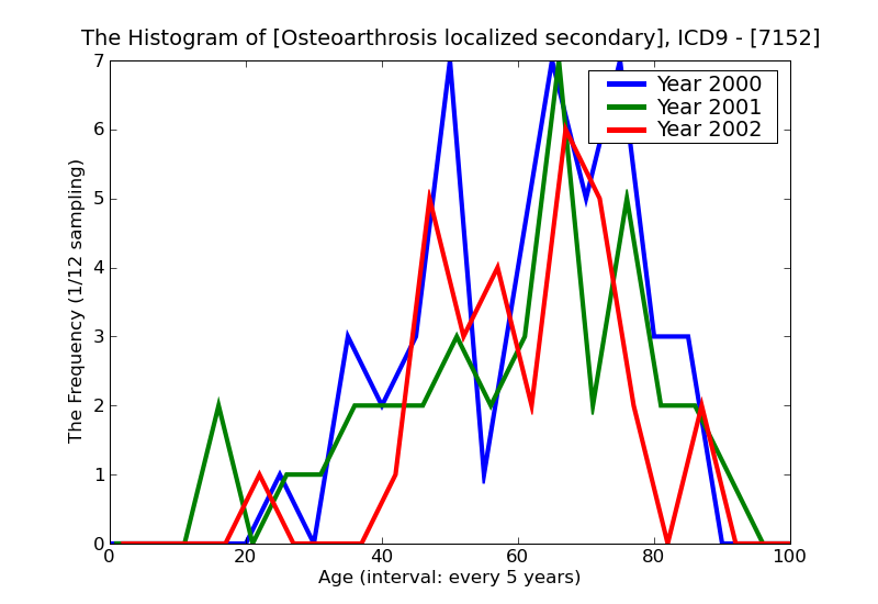 ICD9 Histogram Osteoarthrosis localized secondary