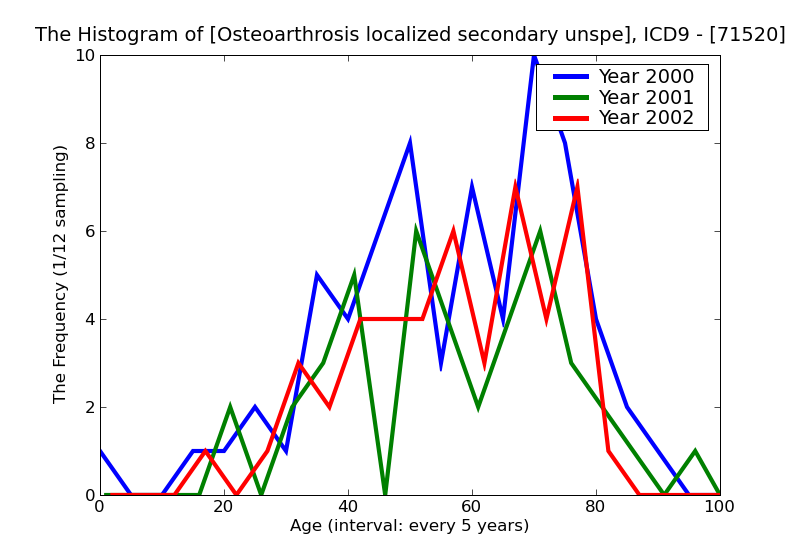 ICD9 Histogram Osteoarthrosis localized secondary unspecified site