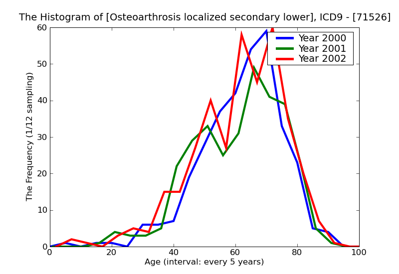 ICD9 Histogram Osteoarthrosis localized secondary lower leg