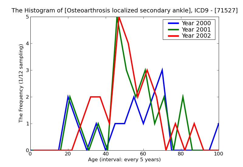 ICD9 Histogram Osteoarthrosis localized secondary ankle and foot