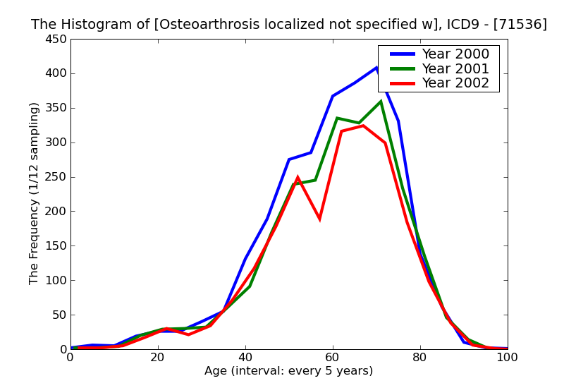 ICD9 Histogram Osteoarthrosis localized not specified whether primary or secondary lower leg